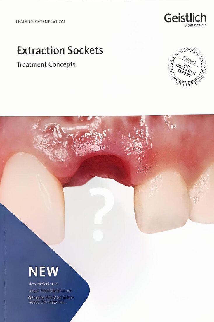 Cover of Extraction Sockets: Treatment Concepts