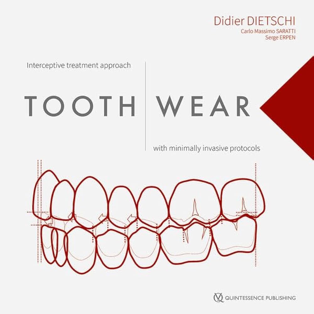 Cover of Tooth Wear: Interceptive Treatment Approach with Minimally Invasive Protocols