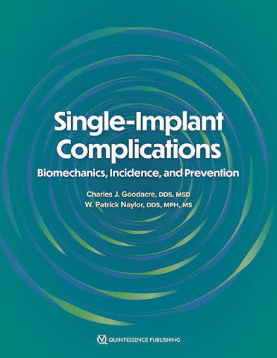 Cover of Single-Implant Complications: Biomechanics, Incidence, and Prevention