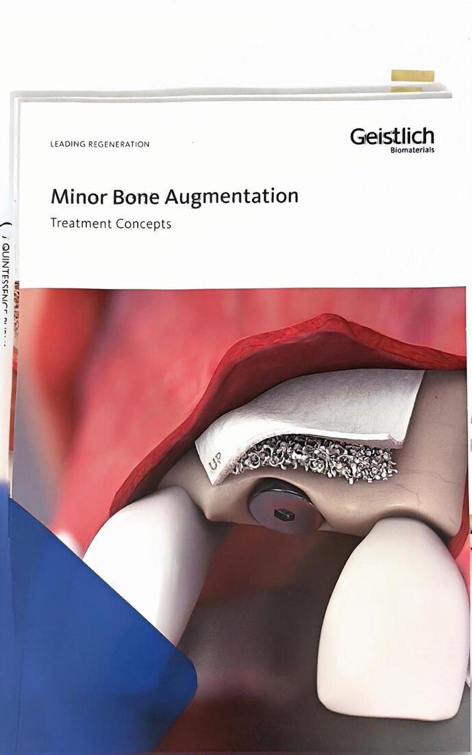 Cover of Minor Bone Augmentation: Treatment Concepts