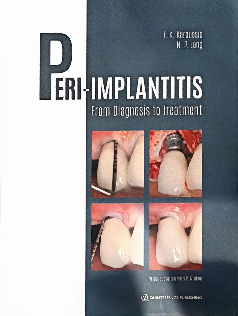 Cover of Peri-Implantitis: From Diagnosis to Treatment