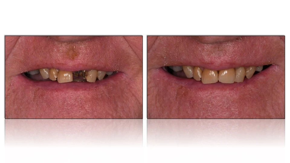 Smile comparison