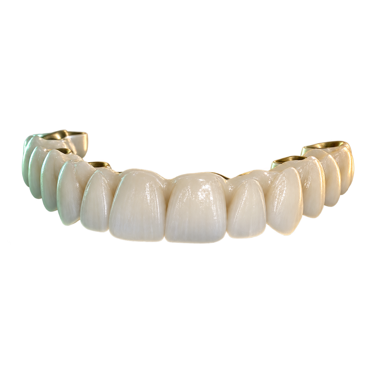 Full arch dental bridge