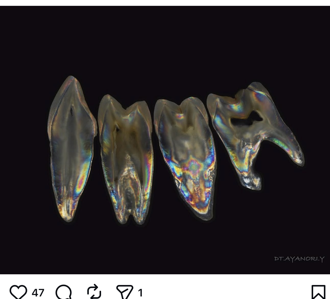 Iridescent dental artwork showing four tooth forms